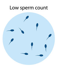 Infertility and Low Sperm Count