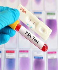 PSA Test - Prostate Specific Antigen